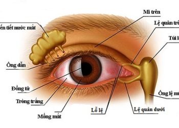 Bệnh lý lệ đạo