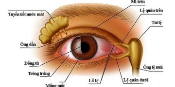 Bệnh lý lệ đạo
